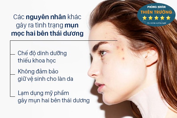 Nổi Mụn ở Thái Dương