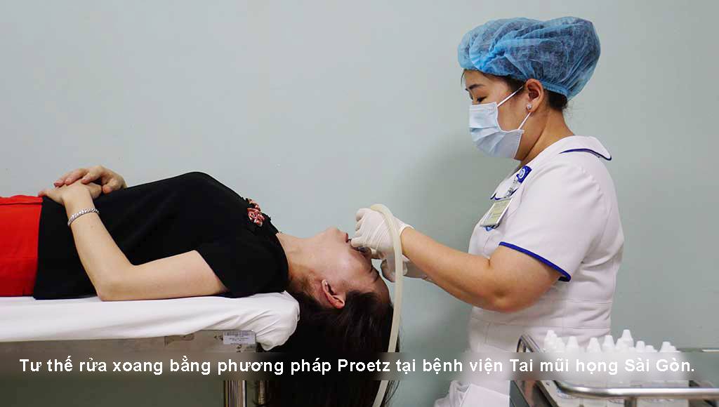 Rửa Mũi Xoang