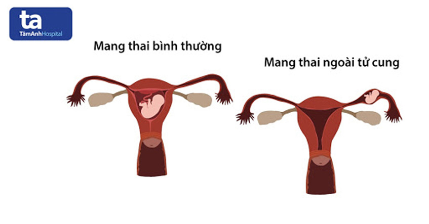 Thai Ngoai Tu Cung