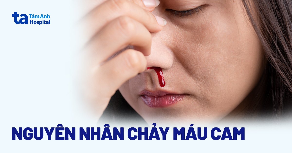 Tự Nhiên Bị Chảy Máu Mũi