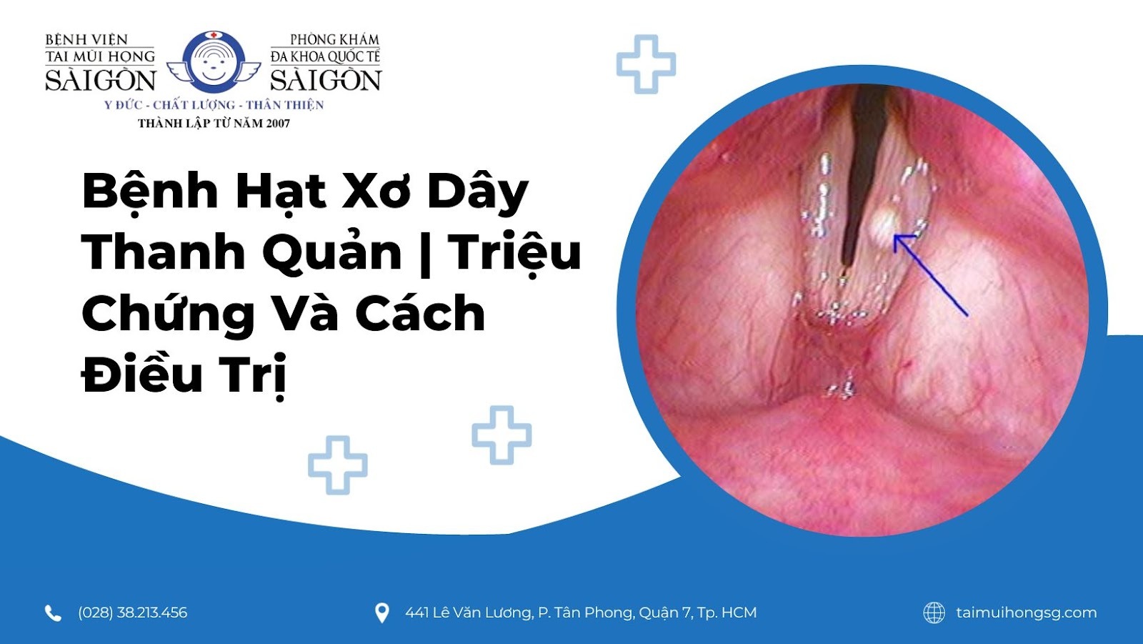 U Xơ Thanh Quản