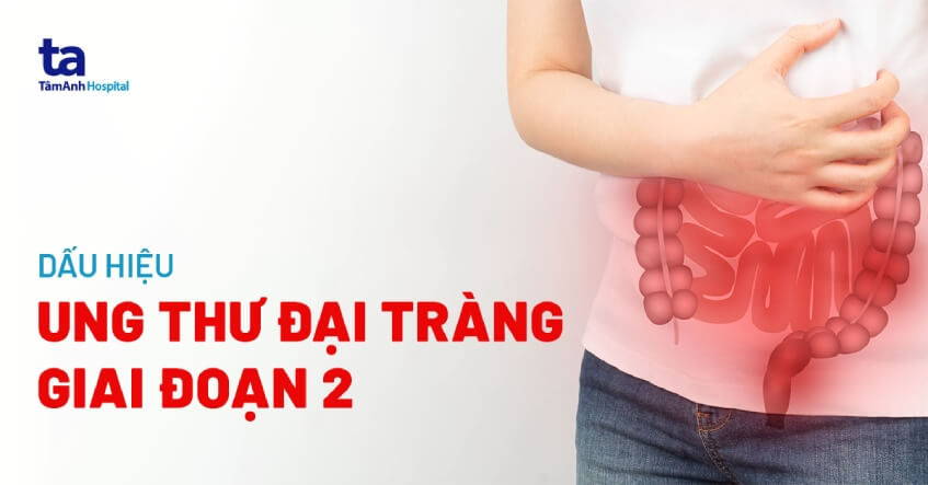 Ung Thư đại Tràng Giai đoạn 2