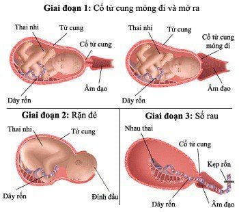 Các Giai đoạn Chuyển Dạ