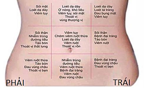 Các Kiểu đau Bụng