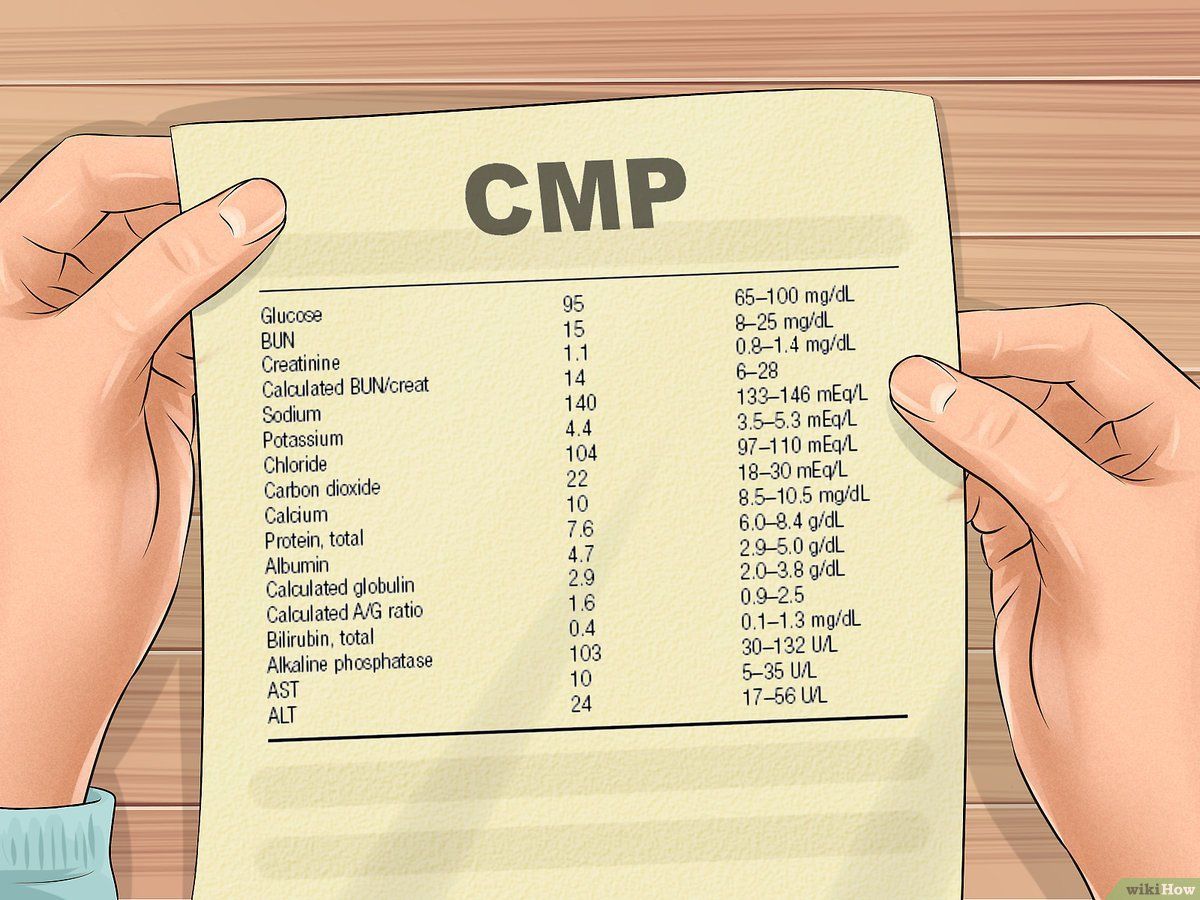 Cmp Là Gì