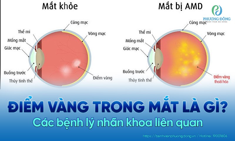 điểm Vàng Là Gì