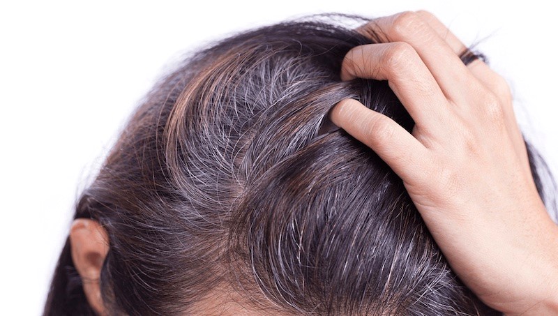 Tóc Bạc Do đâu
