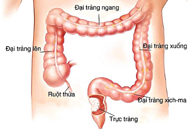 Trực Trị Là Gì