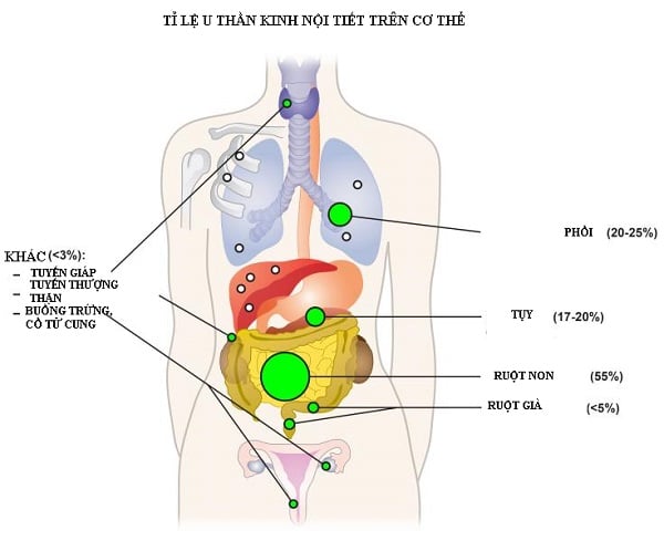 U Thần Kinh Nội Tiết