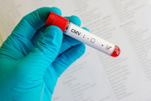 Xét Nghiệm Cmv
